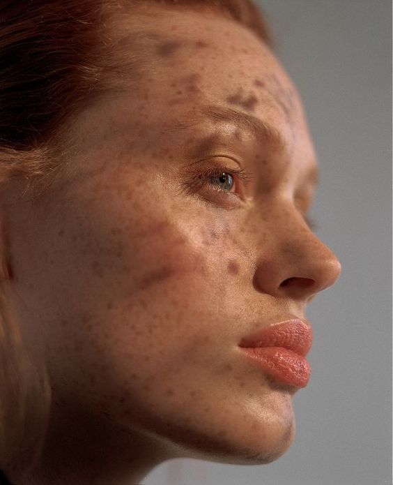 Beauté automnale : comment contrer le manque d’hydratation quand les températures baissent