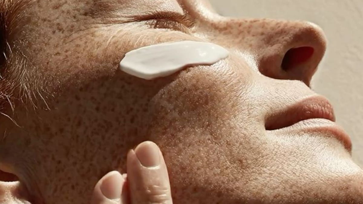 Taches pigmentaires sur le visage : le rôle clé de la protection solaire